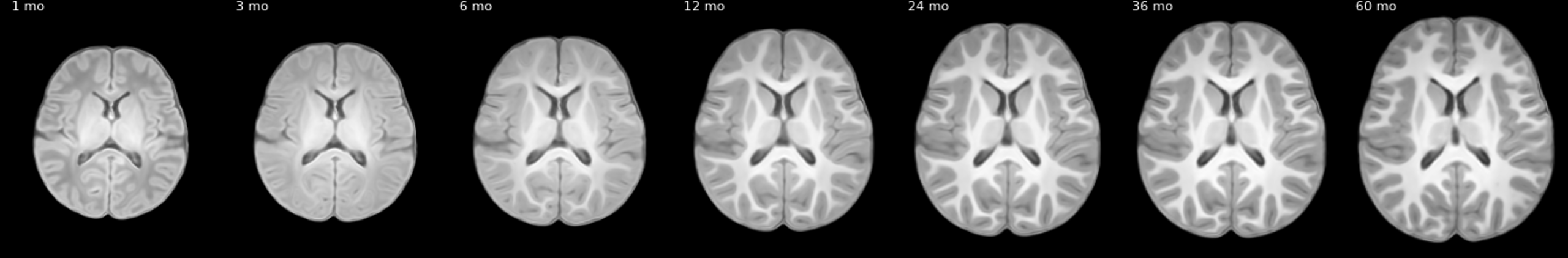 4D infant brain atlases after affine rescaling