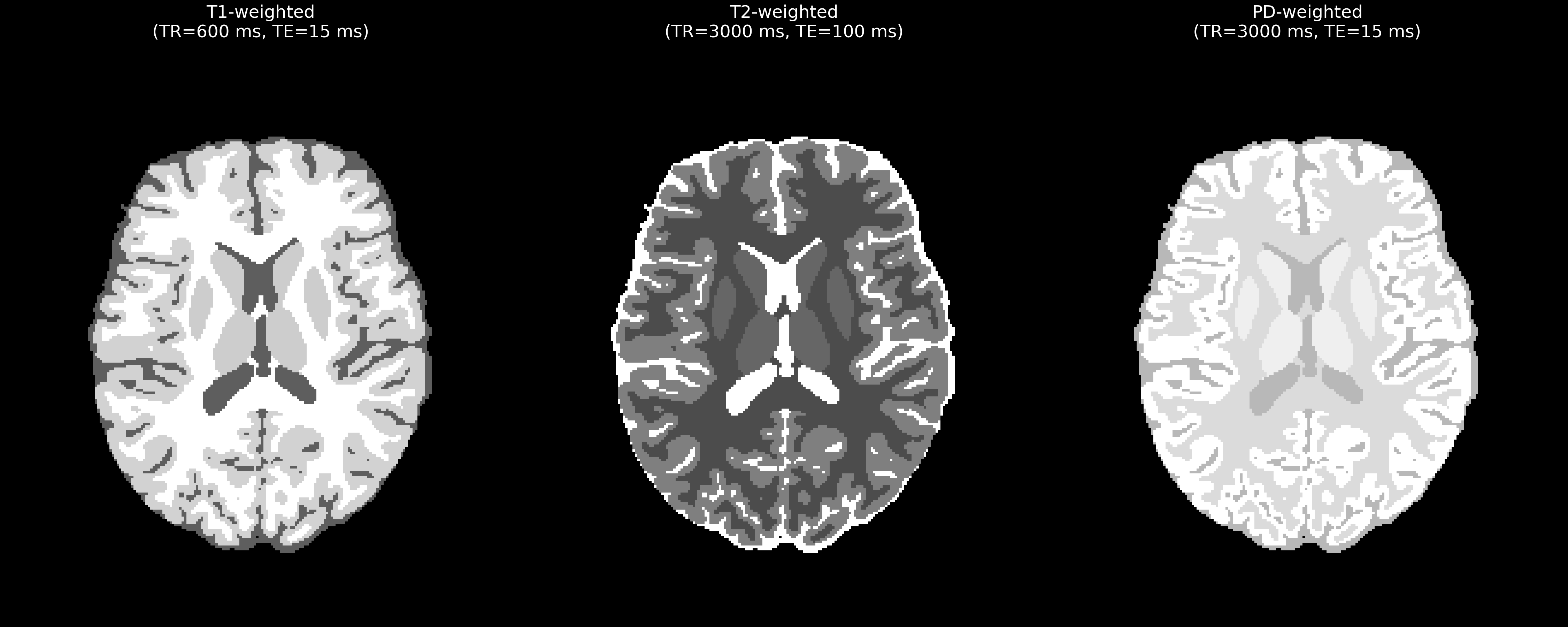Simulated brain phantom